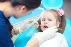 Лечение осложненного кариеса постоянных зубов у детей биологическим методом (2 посещение)